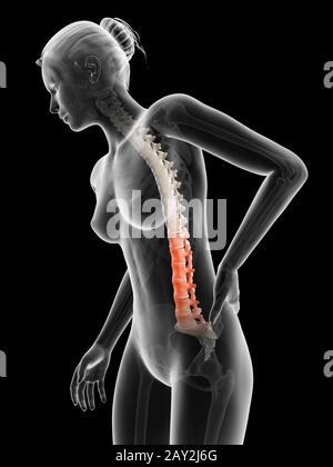 3D gerenderte Illustration - Frau mit akuten Schmerzen im Rücken Stockfoto