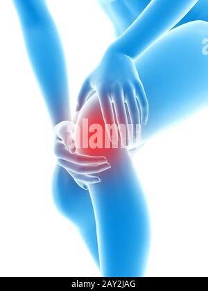 3D gerenderte Illustration - Frau mit Schmerzen im Knie Stockfoto