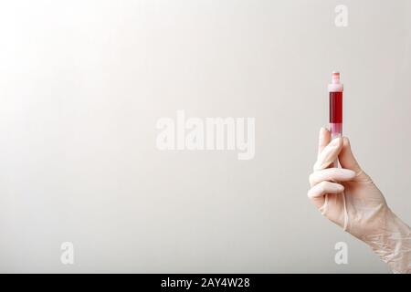 Bluttest im Röhrchen zur Laboranalyse in der Hand der Ärzte. Laboranalyse, biochemische Blutuntersuchungen, medizinische Untersuchungen.weißer Hintergrund mit Stockfoto