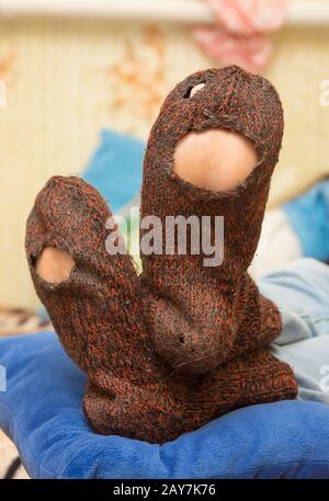 Wollsocken mit riesigen Löchern auf die Beine eines Mannes Stockfoto
