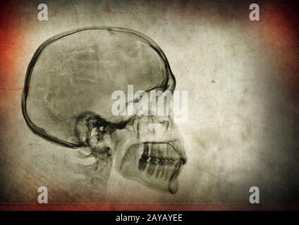 Röntgenschädel auf dunkelstrukturiertem Hintergrund Stockfoto