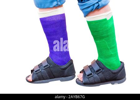 Zwei stehende farbige Gipsbeine mit Schuhen auf Weiß Stockfoto