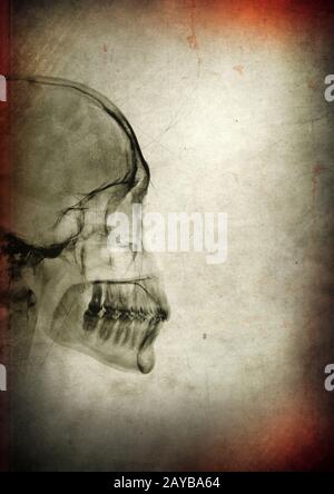 Röntgenschädel auf dunkelstrukturiertem Hintergrund Stockfoto
