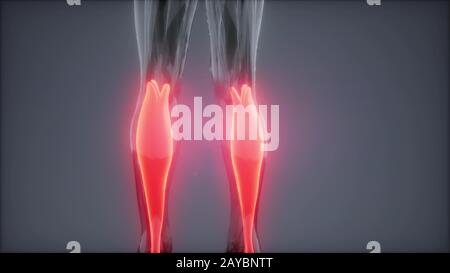 Gastrocnemius - Sichtbare Muskel Anatomie Karte Stockfoto