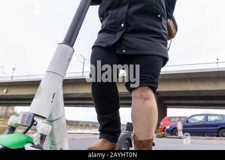 Unfall mit einem Elektro-Roller. Eine Frau ist auf einer Straße in der Stadt von einem Roller gestürzt. Stockfoto