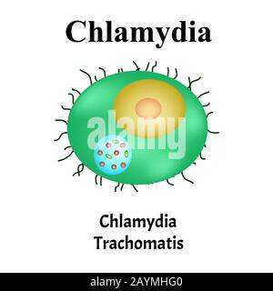 Chlamydia trachomatis. Bakterielle Infektionen Chlamydiose. Sexuell übertragbare Krankheiten. Infografiken. Vektordarstellung auf isoliertem Hintergrund. Stock Vektor