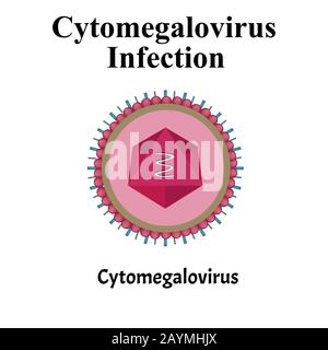 Cytamegalovirus-Struktur. Virusinfektion Zytomegalovirus. Sexuell übertragbare Krankheiten. Infografiken. Vektordarstellung auf isoliertem Hintergrund. Stock Vektor