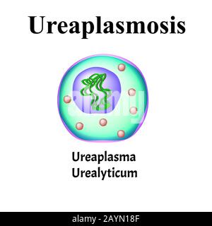 Ureaplasma uralyticum. Bakterielle Infektionen Ureaplasma. Sexuell übertragbare Krankheiten. Infografiken. Vektordarstellung auf isoliertem Hintergrund. Stock Vektor