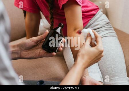 3/4-Ansicht der Mutter, die eine Flasche Antiseptikum und Baumwolle in der Nähe des Ellenbogens der Tochter hält Stockfoto