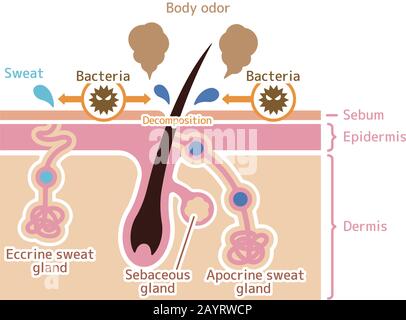 Ursache für Körpergeruchsvektor flache Abbildung Stock Vektor