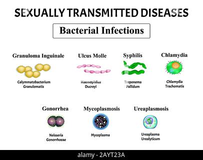 Syphilis, Spirochaete, Treponema, Gonococcus, Gonorrhöe, Chlamydiose, Chlamydien, Mykoplasma, Ureaplasma Bakterieninfektions-Set. Sexuell übertragen Stock Vektor