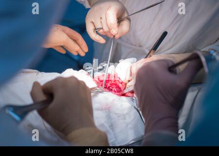 Team von Chirurgen während einer Operation. Sterile Op. Niere Chirurgie in einem kleinen Patienten. Chirurgische Verfahren Diagnose Stockfoto