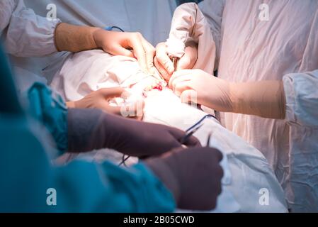 Team von Chirurgen während einer Operation. Sterile Op. Niere Chirurgie in einem kleinen Patienten. Chirurgische Verfahren Diagnose Stockfoto