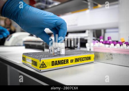 Der klinische Support-Techniker Douglas Condie extrahiert Viren aus den Abstrichproben, so dass die genetische Struktur eines Virus analysiert und im Testlabor Coronavirus in Glasgow Royal Infirmary, Glasgow identifiziert werden kann. Stockfoto