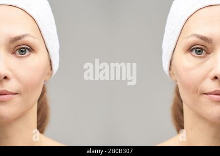 Ziemlich reifes Mädchen. Vor und nach Hochformat. Eine gesunde Therapie gegen Wrincken. Schwarzer Kreis unter den Augen. Kollagencreme. Verjüngung der Kosmetologie. Schönheit Stockfoto