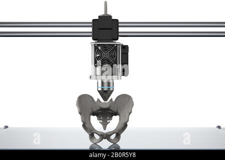 3D-Rendering 3D-Drucker druckt prothetisches Hüftbein Stockfoto