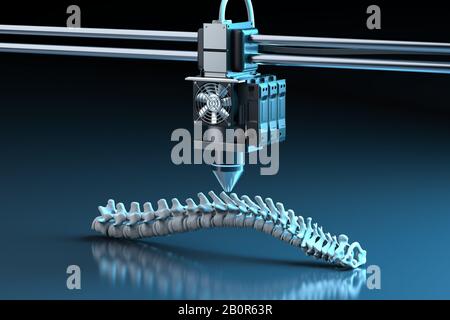 3D-Rendering 3D-Drucker druckt prothetische Wirbelsäule Stockfoto