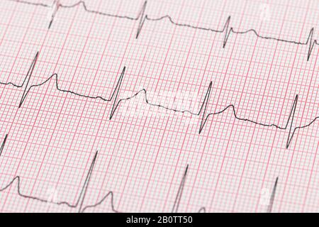 Reelle Linie eines elektroikalen Kardiogramms Stockfoto