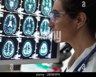 Neurologiediagnose, Gehirnmessung am menschlichen Gehirn auf einem Bildschirm, der von einem weiblichen Arzt in einer Neurologieklinik analysiert wird. Stockfoto