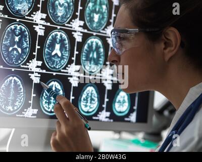 Neurologiediagnose, Gehirnmessung am menschlichen Gehirn auf einem Bildschirm, der von einem weiblichen Arzt in einer Neurologieklinik analysiert wird. Stockfoto