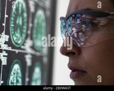 Neurologiediagnose, Gehirnmessung am menschlichen Gehirn auf einem Bildschirm, der von einem weiblichen Arzt in einer Neurologieklinik analysiert wird. Stockfoto