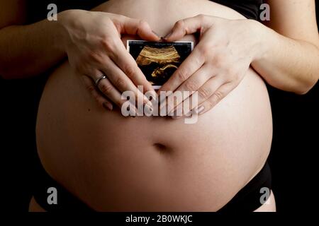 Schwangere Frau mit Ultraschall Stockfoto