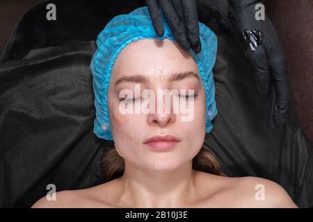 beautician hands smear ointment on the face Stockfoto