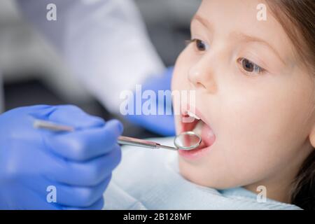 Zahnarzthandschuh, die Zähne des kleinen Mädchens bei geöffnetem Mund untersucht Stockfoto