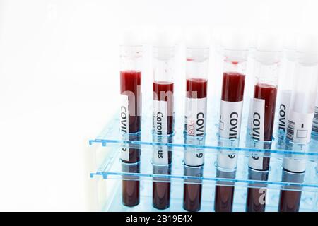 Nahaufnahme des Reagenzgläsergestells mit Blutprobe für Coronavirus, Kovid-19-Virus, auf weißem Hintergrund mit Kopierbereich. Coronavirus positive Blutprobe Stockfoto