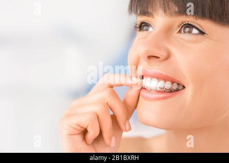 Frau mit kieferorthopädischen Silikon Trainer. Unsichtbare Zahnspangen Ausrichter. Mobile kieferorthopädische Gerät für zahnmedizinische Korrektur. Stockfoto