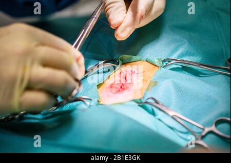 Vorgang bei einem Patienten. Die Hände des Chirurgen in Schutzhandschuhen, die mit medizinischen Werkzeugen operiert werden. Stockfoto