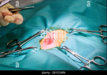 Vorgang bei einem Patienten. Die Hände des Chirurgen in Schutzhandschuhen, die mit medizinischen Werkzeugen operiert werden. Stockfoto