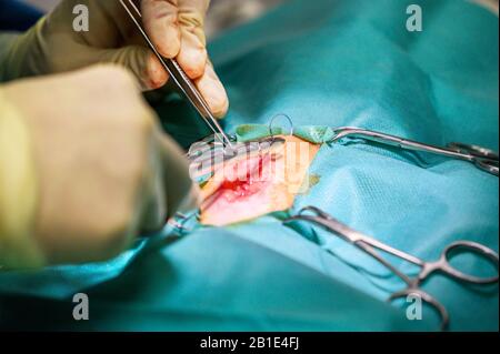 Vorgang bei einem Patienten. Die Hände des Chirurgen in Schutzhandschuhen, die mit medizinischen Werkzeugen operiert werden. Stockfoto