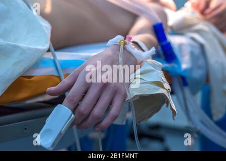 Nahaufnahme einer Hand mit einer Injektionsnadel zur intravenösen Infusion von Lösungen eines kleinen Patienten auf dem Operationstisch. Narkosegpräparat Stockfoto