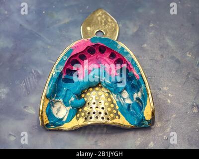 Zähne abdrücken. Dental-Impressionen auf dem Tisch. Zahnformen aus den oberen und unteren Backen aus Silikonmaterial. Stockfoto