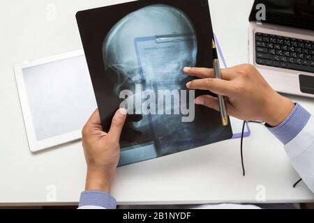 Der Arzt diagnostiziert und analysiert Röntgenaufnahmen des Patienten. Draufsicht aufgenommen. Stockfoto