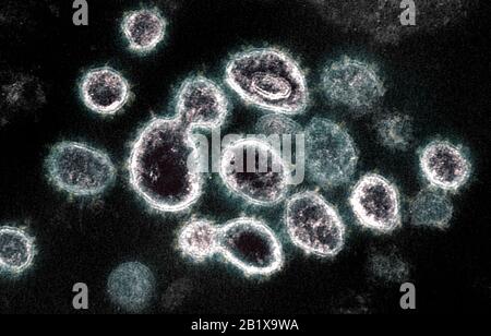 COVID-19. Novel Coronavirus SARS-COV-2 Dieses Transmissionselektronenmikroskop zeigt SARS-COV-2, das Virus, das COVID-19 verursacht, das von einem Patienten in den US-Virus-Partikeln isoliert wird, wird gezeigt, dass es von der Oberfläche der im Labor kultivierten Zellen abstammt. Die Stacheln am äußeren Rand der Viruspartikel geben Coronaviren ihren Namen, kronenartig. Gutschrift: NIAID-RML Stockfoto