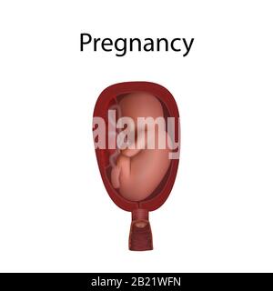 Schwangerschaft, Abbildung Stockfoto