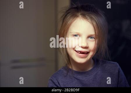 Ein Mädchen im Schulalter ohne Fronttoten lacht. Nahaufnahme. Zahnwechsel. Stockfoto