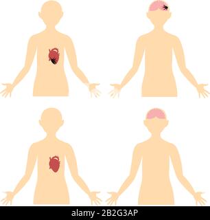 Herzinfarkt, Schlaganfall, Thrombose. Erkrankungen des Gehirns und des Herzens. Anatomie. Schema des menschlichen Körpers. Stock Vektor