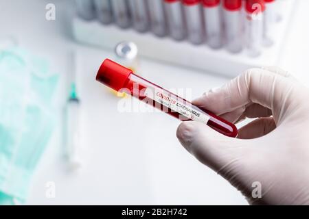 Arzt mit medizinischen Handschuhen, die ein Blutrohr mit positiver Coronavirus 2019-nCoV-Blutprobe halten. Stockfoto