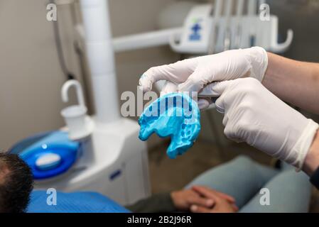 Der Zahnarzt hält die Zahnform des Patienten mit Latexhandschuhen fest. Stockfoto