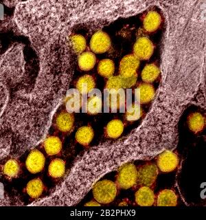 Ein Transmissionselektronenmikrograph aus COVID-19, neuartigen Coronavirus, Virus-Partikeln, isoliert von einem Patienten, der in der NIAID Integrated Research Facility am 28. Februar 2020 in Fort Detrick, Maryland erfasst und farbverbessert wurde. Stockfoto