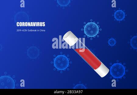 Coronavirus (2019-NC0V) in Virusröhre. Ausbruch in China und Verbreitung auf der ganzen Welt. Das Virus greift die Gesundheit der Atemwege an. Stock Vektor