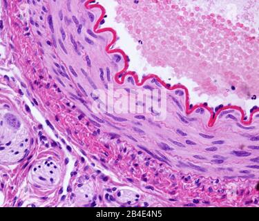 Helle Mikrografik einer muskulären Arterie mit Querschnitten, die eine dicke und wellige innere elastische Lamina zeigt, eine mittlere Schicht mit glatten Muskelfasern und Stockfoto