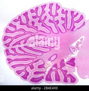 Sagittaler Abschnitt eines jungen Kleinhirns, der viele verästigte zerebelläre Lamellen zeigt. Lichtmikrograph. Hämatoxylin & Eosin Fleck. Stockfoto