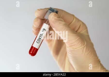 Laborprobe der Blutuntersuchungen zur Diagnose neue Corona-Virusinfektion COVID-19 aus Wuhan, China. Pandemic Infektionskonzept. Stockfoto