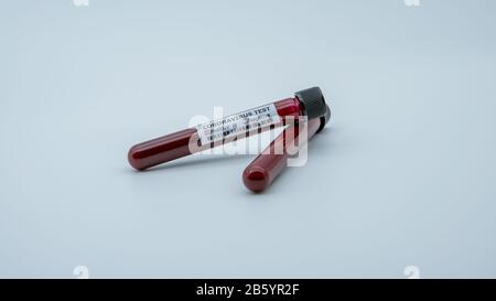 Reagenzglas mit infizierter Blutprobe für COVID-19, neuartiges Coronavirus in Wuhan, China. Impfstoffforschung für Virus 2019-nCoV. Konzept von gegen t Stockfoto