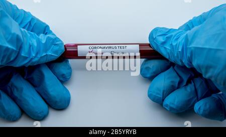Reagenzglas mit infizierter Blutprobe für COVID-19, neuartiges Coronavirus in Wuhan, China. Wissenschaftler mit blauen Schutzhandschuhen. Impfstoffforschung Stockfoto