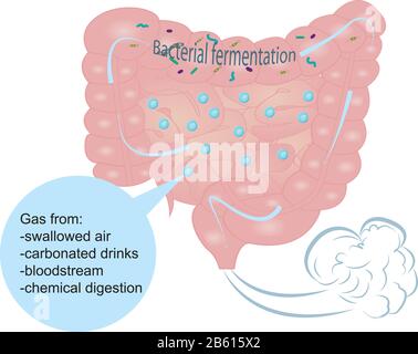 Aufblähen und überschüssiges Gas im Darm Stock Vektor